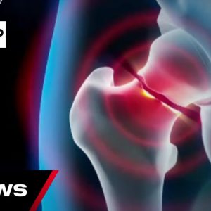 Ambitious new guidelines planned for fast-tracked hip surgeries | 7NEWS